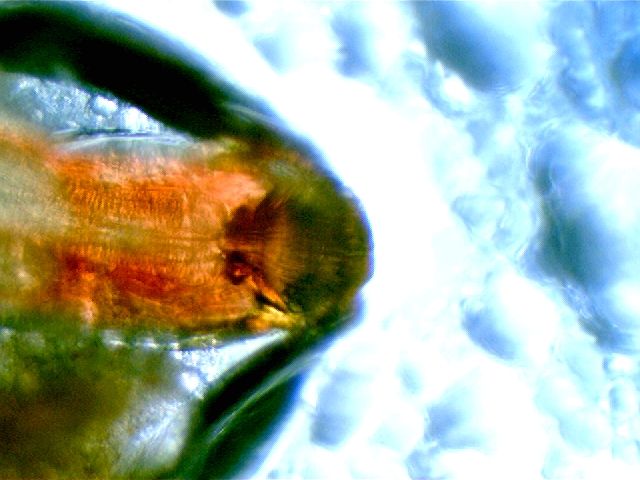 Nicienie Camallanus.jpg