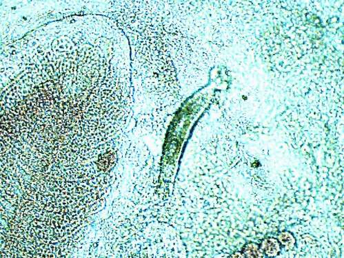 dactylogyrus 2 200x.JPG