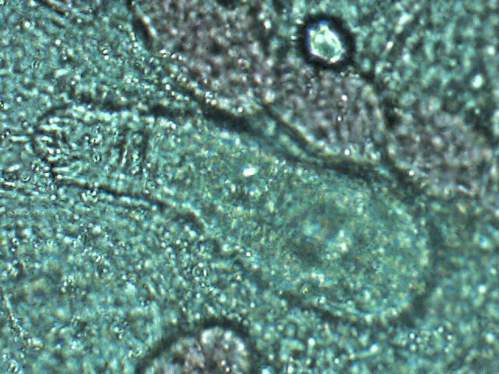 dactylogyrus 4 700x.JPG