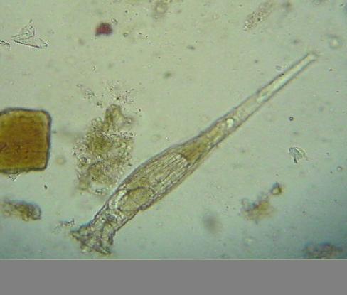 Rotatoria rotatoria.JPG